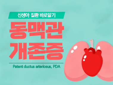 [신생아 질환 바로알기] 동맥관 개존증 (Patent Ductus Arteriosus, PDA)