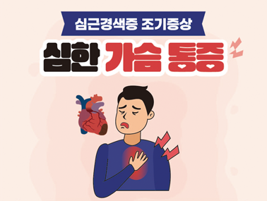 [인포그래픽] 심근경색증 조기증상 - 심한 가슴통증