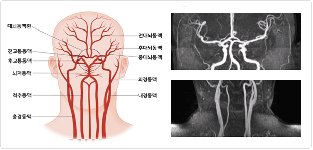 대뇌동맥환, 전교통동맥, 후교통동맥, 뇌저동맥, 척추동맥, 총경동맥, 전대뇌동맥, 후대뇌동맥, 중대뇌동맥, 외경동맥, 내경동맥