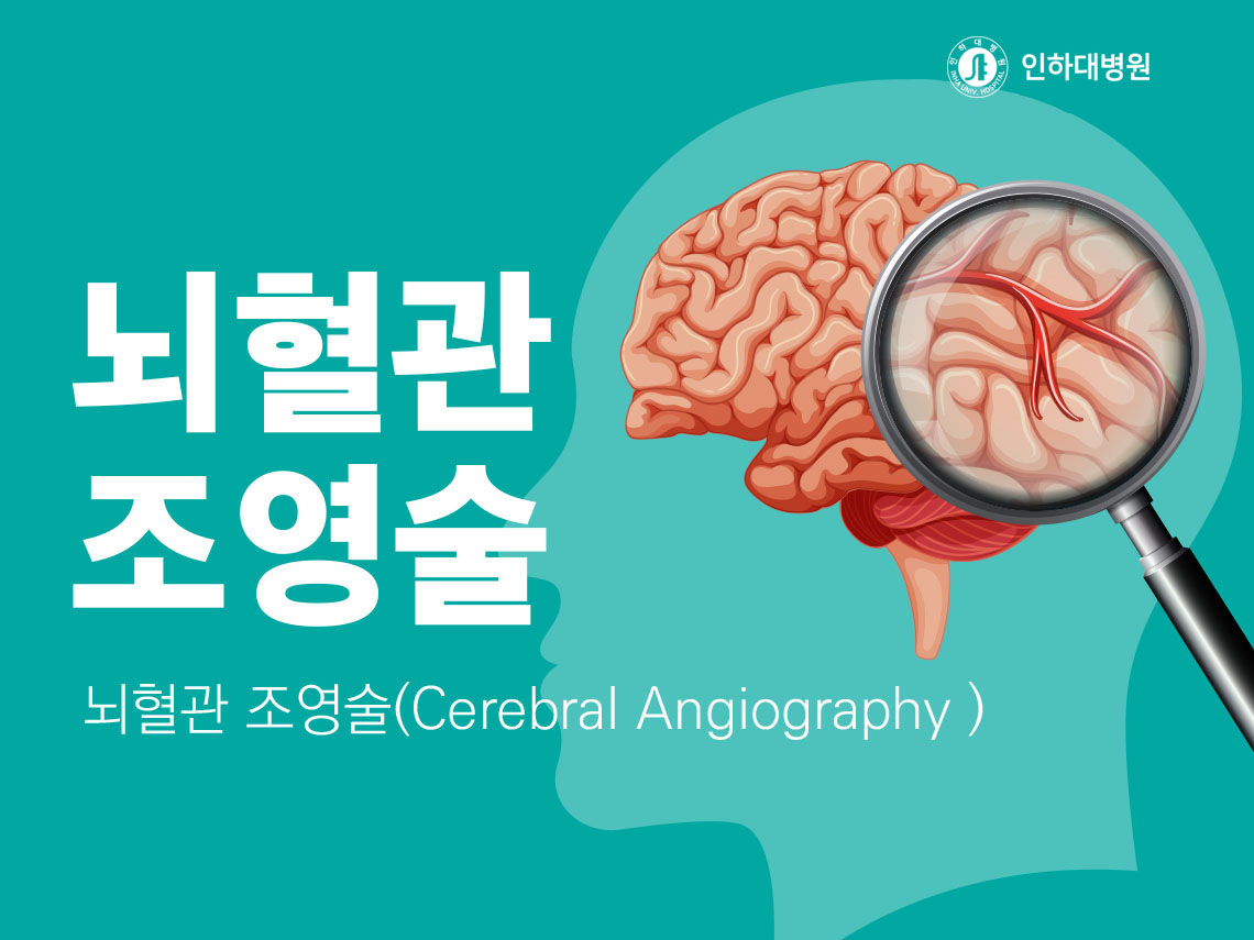 [건강의학정보] 뇌혈관 조영술