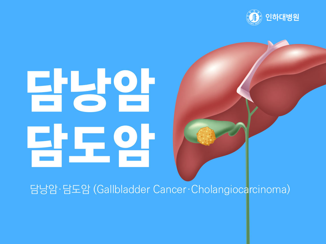 [건강의학정보] 담낭암/담도암