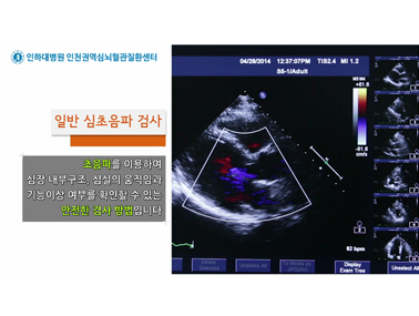 심혈관ㅣ일반 심초음파 검사