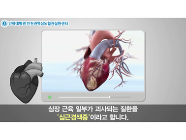 심혈관ㅣ심근경색증