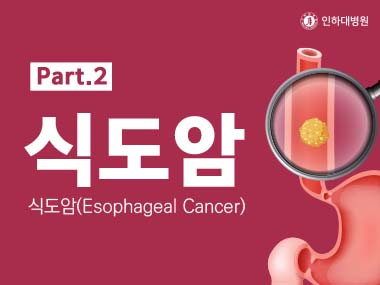 [건강의학정보]  식도암의 진단방법