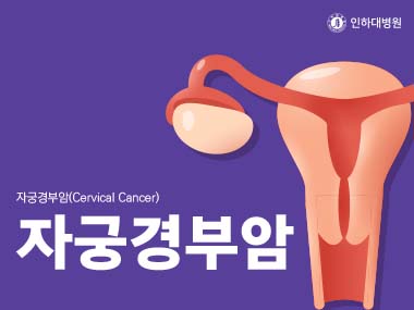 [건강의학정보] 자궁경부암