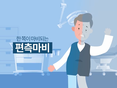 뇌졸중 조기증상(2019)