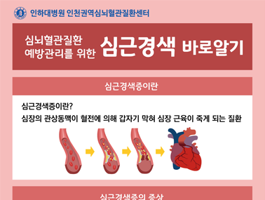 [인포그래픽] 심뇌혈관질환 예방관리를 위한 심근경색 바로 알기