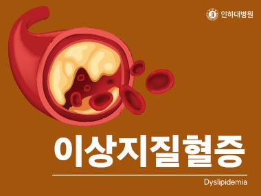 [건강의학정보] 이상지질혈증