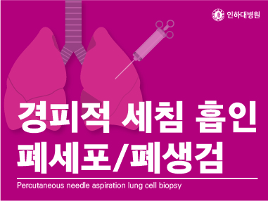 [건강의학정보] 경피적 세침 흡인 폐세포, 폐생검