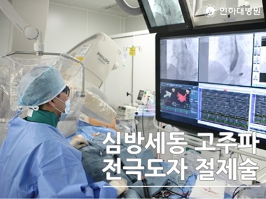 [건강의학정보] 심방세동 고주파 전극도자 절제술