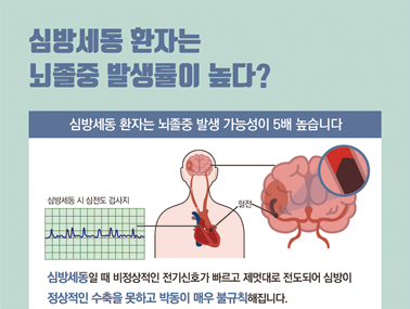 [인포그래픽] 심방세동 환자는 뇌졸중 발생률이 높다?