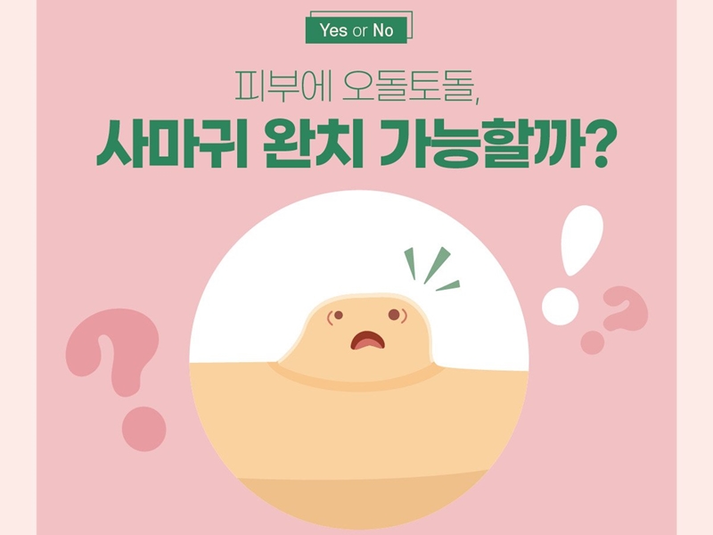 [Yes or No] 피부에 오돌토돌, 사마귀 완치 가능할까?