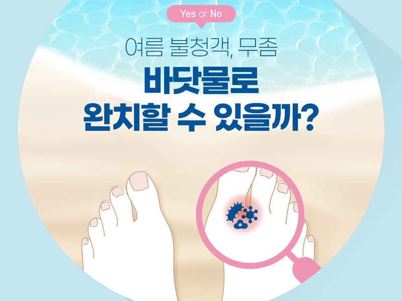 [Yes or No] 여름 불청객 무좀, 바닷물로 완치할 수 있을까?