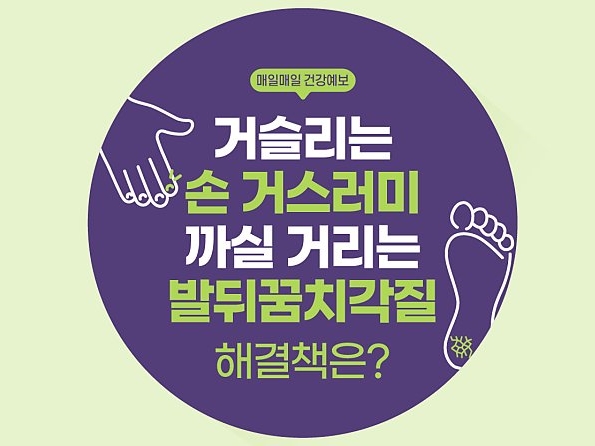 [매일매일 건강예보] 손 거스러미, 발뒤꿈치각질 해결책은?
