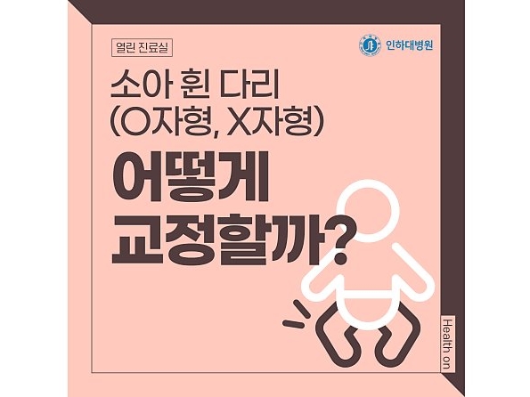 [열린 진료실] 소아 휜 다리(O자형, X자형), 어떻게 교정할까?