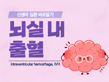 [신생아 질환 바로알기] 뇌실 내 출혈 (Intraventricular Hemorrhage, IVH)