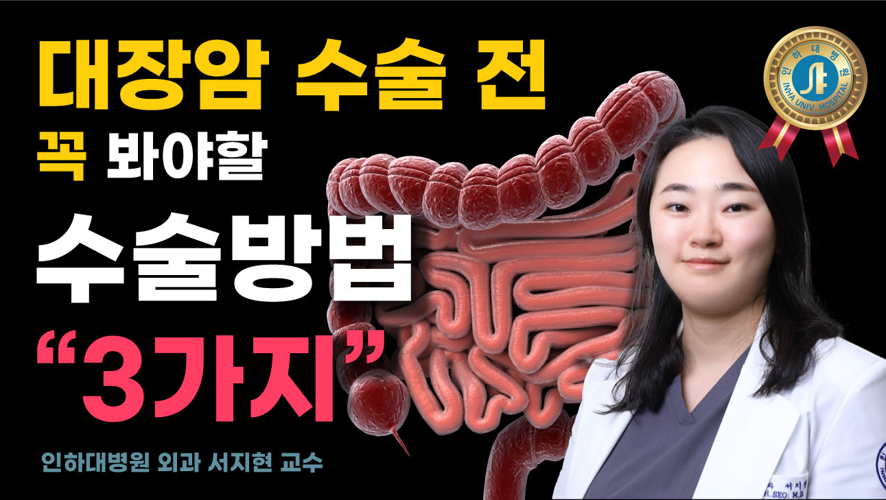 대장암 수술 전 꼭 봐야할 수술 방법 "3가지" - 외과 서지현 교수