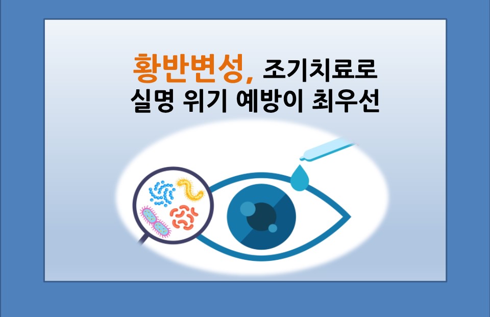 [의학칼럼] 황반변성, 조기 치료로 실명 위기 예방이 최우선