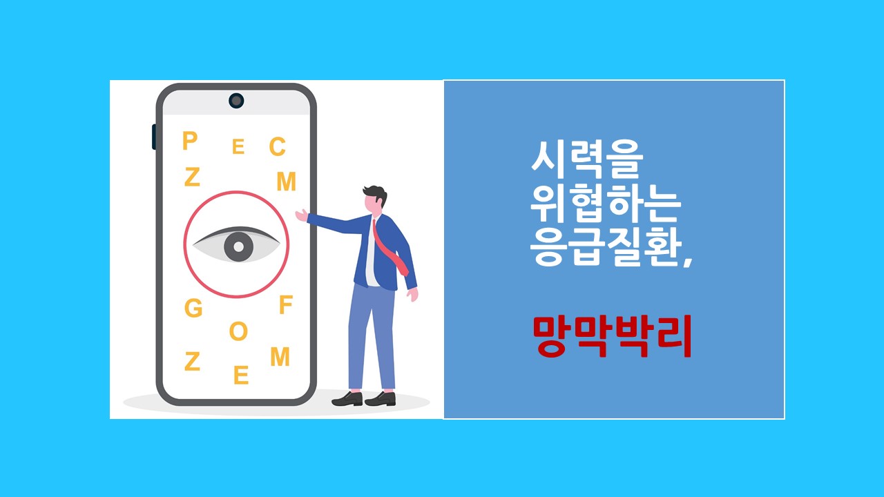 [의학칼럼] 시력을 위협하는 응급 질환, 망막박리